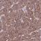 EI24 Autophagy Associated Transmembrane Protein antibody, HPA047165, Atlas Antibodies, Immunohistochemistry paraffin image 