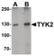 Tyrosine Kinase 2 antibody, PA5-34497, Invitrogen Antibodies, Western Blot image 
