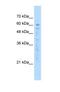 EF-Hand Calcium Binding Domain 14 antibody, NBP1-59967, Novus Biologicals, Western Blot image 