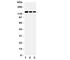 Collagen Type I Alpha 1 Chain antibody, R31258, NSJ Bioreagents, Western Blot image 