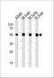 Aldehyde Dehydrogenase 2 Family Member antibody, 57-650, ProSci, Western Blot image 