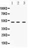 TNF Receptor Superfamily Member 10a antibody, PA5-80143, Invitrogen Antibodies, Western Blot image 