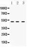 TNF Receptor Superfamily Member 10a antibody, PA5-80143, Invitrogen Antibodies, Western Blot image 