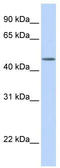 Transducin beta-like protein 2 antibody, TA335650, Origene, Western Blot image 