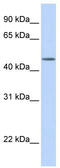 Transducin beta-like protein 2 antibody, TA335650, Origene, Western Blot image 