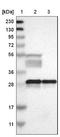 Tyrosine 3-Monooxygenase/Tryptophan 5-Monooxygenase Activation Protein Beta antibody, NBP1-80611, Novus Biologicals, Western Blot image 