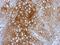 Bromodomain Containing 9 antibody, NBP2-15614, Novus Biologicals, Immunohistochemistry paraffin image 