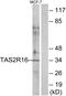 Taste 2 Receptor Member 16 antibody, GTX87510, GeneTex, Western Blot image 