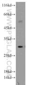 Major Histocompatibility Complex, Class II, DR Beta 5 antibody, 21702-1-AP, Proteintech Group, Western Blot image 