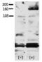 Erb-B2 Receptor Tyrosine Kinase 4 antibody, PA5-12607, Invitrogen Antibodies, Western Blot image 