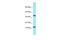 Testis-specific basic protein Y 2 antibody, A14955, Boster Biological Technology, Western Blot image 