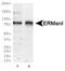 Mannosidase Alpha Class 1B Member 1 antibody, GTX03413, GeneTex, Western Blot image 