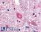 G Protein-Coupled Receptor 88 antibody, LS-A6318, Lifespan Biosciences, Immunohistochemistry frozen image 