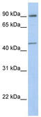 General Transcription Factor IIH Subunit 4 antibody, TA330621, Origene, Western Blot image 