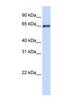 Heat Shock Protein Family A (Hsp70) Member 2 antibody, NBP1-58213, Novus Biologicals, Western Blot image 