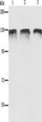 Damage Specific DNA Binding Protein 1 antibody, CSB-PA056628, Cusabio, Western Blot image 