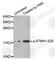 Stathmin 1 antibody, AP0220, ABclonal Technology, Western Blot image 