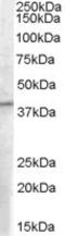 Eukaryotic Translation Initiation Factor 3 Subunit M antibody, LS-B2296, Lifespan Biosciences, Western Blot image 