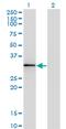 Homeobox A1 antibody, MA5-19110, Invitrogen Antibodies, Western Blot image 