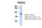 Tissue Specific Transplantation Antigen P35B antibody, 27-208, ProSci, Western Blot image 