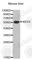 Keratin 4 antibody, A2661, ABclonal Technology, Western Blot image 