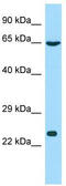 Glutathione S-Transferase C-Terminal Domain Containing antibody, TA332248, Origene, Western Blot image 