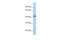 Serum Response Factor Binding Protein 1 antibody, 26-563, ProSci, Western Blot image 