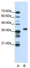 Poly(rC)-binding protein 1 antibody, TA345948, Origene, Western Blot image 