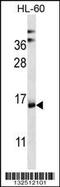 NADH:Ubiquinone Oxidoreductase Complex Assembly Factor 4 antibody, 56-779, ProSci, Western Blot image 