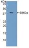 Galectin 8 antibody, MBS2001752, MyBioSource, Western Blot image 