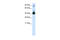 Forkhead Box H1 antibody, 28-576, ProSci, Western Blot image 