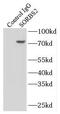 Sorbin And SH3 Domain Containing 2 antibody, FNab08112, FineTest, Immunoprecipitation image 