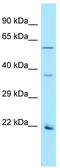 Olfactory Receptor Family 2 Subfamily AG Member 1 (Gene/Pseudogene) antibody, TA334153, Origene, Western Blot image 