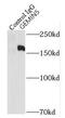 Gem Nuclear Organelle Associated Protein 5 antibody, FNab03420, FineTest, Immunoprecipitation image 