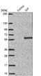 Cobalamin Binding Intrinsic Factor antibody, PA5-58977, Invitrogen Antibodies, Western Blot image 