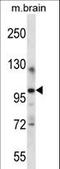 Itchy E3 Ubiquitin Protein Ligase antibody, LS-C165311, Lifespan Biosciences, Western Blot image 
