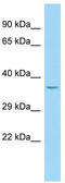 Pleckstrin Homology Domain Containing A3 antibody, TA331348, Origene, Western Blot image 