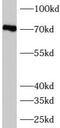 Activator Of Transcription And Developmental Regulator AUTS2 antibody, FNab00750, FineTest, Western Blot image 