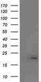 MCTS1 Re-Initiation And Release Factor antibody, MA5-25417, Invitrogen Antibodies, Western Blot image 