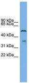 Beta-1,3-Glucuronyltransferase 3 antibody, TA341900, Origene, Western Blot image 