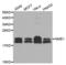 NME/NM23 Nucleoside Diphosphate Kinase 1 antibody, LS-C330879, Lifespan Biosciences, Western Blot image 