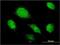 Alpha-1-Microglobulin/Bikunin Precursor antibody, H00000259-M01, Novus Biologicals, Immunocytochemistry image 