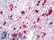 S100 Calcium Binding Protein A9 antibody, LS-C317323, Lifespan Biosciences, Immunohistochemistry paraffin image 