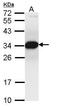 Proteasome Inhibitor Subunit 1 antibody, TA308605, Origene, Western Blot image 
