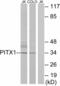 Paired Like Homeodomain 1 antibody, A02993, Boster Biological Technology, Western Blot image 