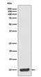 S100 Calcium Binding Protein A6 antibody, M02043, Boster Biological Technology, Western Blot image 