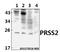 Serine Protease 2 antibody, A05763, Boster Biological Technology, Western Blot image 