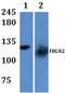 Fibulin 2 antibody, PA5-75911, Invitrogen Antibodies, Western Blot image 