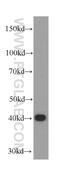 Survival Of Motor Neuron 2, Centromeric antibody, 60255-1-Ig, Proteintech Group, Western Blot image 