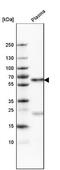 Serpin Family A Member 3 antibody, NBP1-90295, Novus Biologicals, Western Blot image 